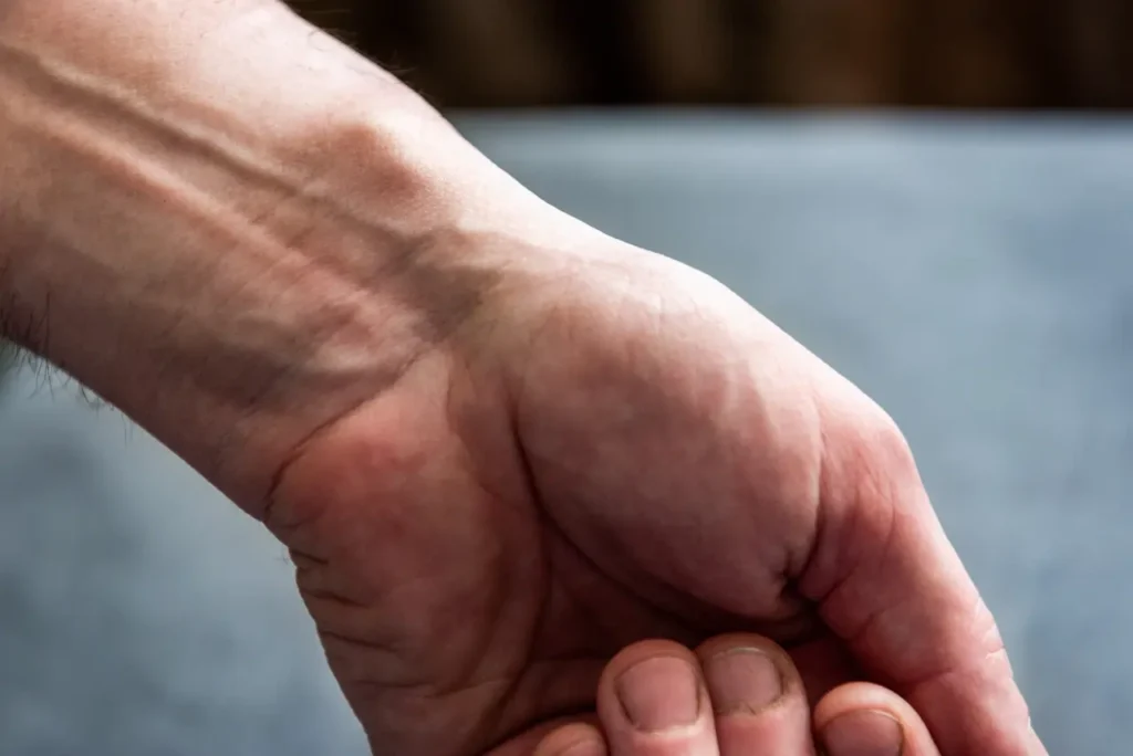 גנגליון וולארי